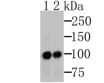 Western Blot: MSH2 Antibody (10G2) [NBP2-76896] - Western blot analysis of MSH2 on K562 cells lysates using anti-MSH2 antibody.Lane 1: Anti-MSH2 antibody, 1:500.Lane 2: Anti-MSH2 antibody, 1:5,000.