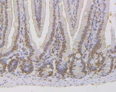 Immunohistochemistry: MSH2 Antibody (10G3) [NBP2-76898] - Immunohistochemical analysis of paraffin-embedded mouse colon tissue using anti-MSH2 antibody. Counter stained with hematoxylin. The section was pre-treated using heat mediated antigen retrieval with sodium citrate buffer (pH6) for 20 mins.
