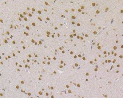 Immunohistochemistry: MSH2 Antibody (10G3) [NBP2-76898] - Immunohistochemical analysis of paraffin-embedded rat brain tissue using anti-MSH2 antibody. Counter stained with hematoxylin. The section was pre-treated using heat mediated antigen retrieval with sodium citrate buffer (pH6) for 20 mins.