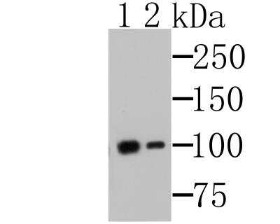 Western Blot: MSH2 Antibody (10G3) [NBP2-76898] - Western blot analysis of MSH2 on K562 cells lysates using anti-MSH2 antibody.Lane 1: Anti-MSH2 antibody, 1:500.Lane 2: Anti-MSH2 antibody, 1:5,000.
