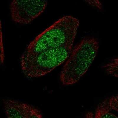 Immunocytochemistry/Immunofluorescence: MSH2 Antibody [NBP2-68845] - Staining of human cell line RH-30 shows localization to nucleoplasm.