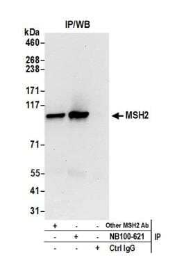 <b>Independent Antibodies Validation. </b>Immunoprecipitation: MSH2 Antibody [NB100-621] - Detection of human MSH2 by western blot of immunoprecipitates. Samples: Whole cell lysate (0.5 or 1.0 mg per IP reaction; 20% of IP loaded) from HeLa cells prepared using NETN lysis buffer. Antibodies: Affinity purified rabbit anti-MSH2 antibody NB100-621 used for IP at 6 ug per reaction. MSH2 was also immunoprecipitated by another rabbit anti-MSH2 antibody. For blotting immunoprecipitated MSH2, NB100-621 was used at 1 ug/ml. Detection: Chemiluminescence with an exposure time of 30 seconds.