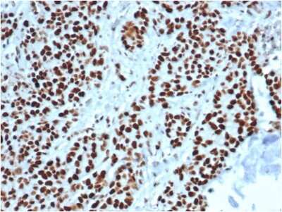 Immunohistochemistry-Paraffin: MSH2 Antibody (MSH2/6549R) - Azide and BSA Free [NBP3-08958] - Formalin-fixed, paraffin-embedded human colon stained with MSH2 Recombinant Rabbit Monoclonal Antibody (MSH2/6549R).