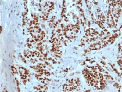 Immunohistochemistry-Paraffin: MSH2 Antibody (rMSH2/6548) [NBP3-07210] - Formalin-fixed, paraffin-embedded human colon stained with MSH2 Recombinant Mouse Monoclonal Antibody (rMSH2/6548).