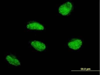 Immunocytochemistry/ Immunofluorescence MSH5 Antibody (1C11)