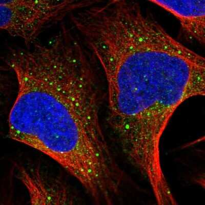 Immunocytochemistry/Immunofluorescence: MSH5 Antibody [NBP2-57274] - Staining of human cell line U-2 OS shows localization to endoplasmic reticulum & vesicles.