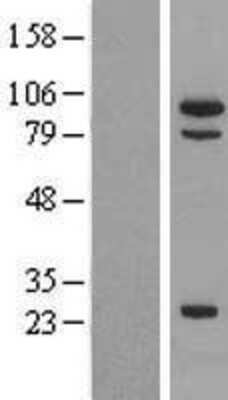 Western Blot MSH5 Overexpression Lysate