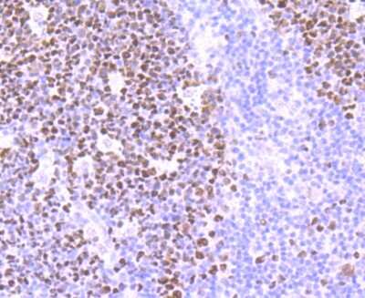 Immunohistochemistry-Paraffin: MSH6 Antibody (JA84-26) [NBP2-66959] - Analysis of paraffin-embedded human lung tissue using anti-MSH6 antibody. Counter stained with hematoxylin.