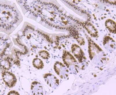 Immunohistochemistry-Paraffin: MSH6 Antibody (JA84-26) [NBP2-66959] - Analysis of paraffin-embedded mouse colon tissue using anti-MSH6 antibody. Counter stained with hematoxylin.