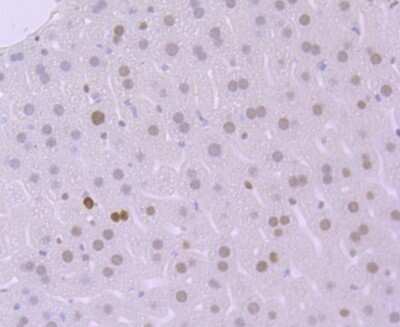 Immunohistochemistry-Paraffin: MSH6 Antibody (JA84-26) [NBP2-66959] - Analysis of paraffin-embedded mouse liver tissue using anti-MSH6 antibody. Counter stained with hematoxylin.