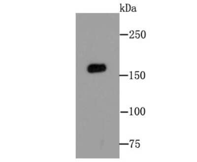 Western Blot: MSH6 Antibody (JA84-26) [NBP2-66959] - Analysis of MSH6 on Hela cell lysates using anti-MSH6 at 1/500 dilution.