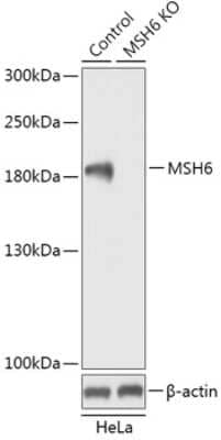 Western Blot: MSH6 Antibody [NBP3-03860] - Analysis of extracts from normal (control) and MSH6 knockout (KO) HeLa cells, using MSH6 antibody at 1:300 dilution. Secondary antibody: HRP Goat Anti-Rabbit IgG (H+L) at 1:10000 dilution. Lysates/proteins: 25ug per lane. Blocking buffer: 3% nonfat dry milk in TBST.