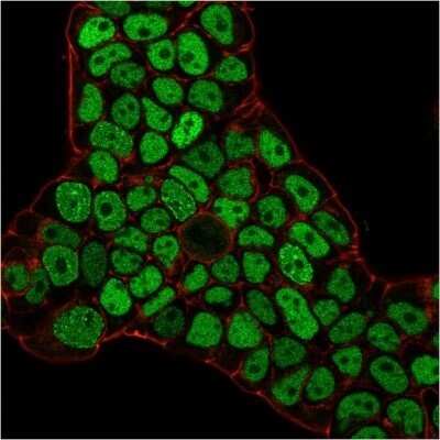 Immunocytochemistry/Immunofluorescence: MSH6 Antibody (MSH6/3086) - Azide and BSA Free [NBP2-79846] - Immunofluorescence staining of PFA-fixed MCF-7 cells with MSH6 Antibody (MSH6/3086) followed by goat anti-Mouse IgG-CF488 (Green). Nuclei are labeled with RedDot (Red).