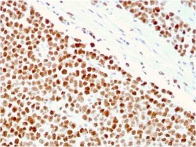 Immunohistochemistry-Paraffin: MSH6 Antibody (MSH6/3086) - Azide and BSA Free [NBP2-79846] - Formalin-fixed, paraffin-embedded human Small Intestine stained with MSH6 Antibody (MSH6/3086).