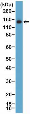 Western Blot: MSH6 Antibody (RM376) [NBP2-77434] - Western Blot of 293 lysate using NBP2-77434.