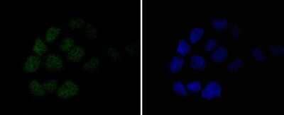 Immunocytochemistry/Immunofluorescence: MSH6 Antibody (SP08-02) [NBP2-67379] - Staining MSH6 in A431 cells (green). The nuclear counter stain is DAPI (blue). Cells were fixed in paraformaldehyde, permeabilised with 0.25% Triton X100/PBS.