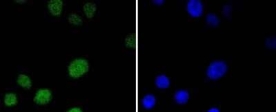 Immunocytochemistry/Immunofluorescence: MSH6 Antibody (SP08-02) [NBP2-67379] - Staining MSH6 in A549 cells (green). The nuclear counter stain is DAPI (blue). Cells were fixed in paraformaldehyde, permeabilised with 0.25% Triton X100/PBS.