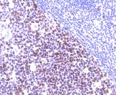 Immunohistochemistry-Paraffin: MSH6 Antibody (SP08-02) [NBP2-67379] - Analysis of paraffin-embedded human tonsil tissue using anti-MSH6 antibody. Counter stained with hematoxylin.