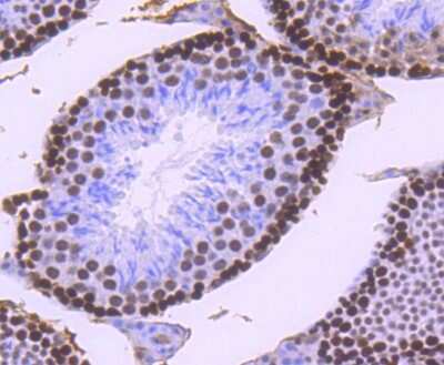 Immunohistochemistry-Paraffin: MSH6 Antibody (SP08-02) [NBP2-67379] - Analysis of paraffin-embedded mouse testis tissue using anti-MSH6 antibody. Counter stained with hematoxylin.