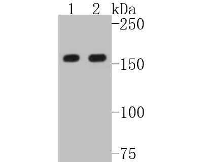 Western Blot: MSH6 Antibody (SP08-02) [NBP2-67379] - Western blot analysis of MSH6 on different lysates. Proteins were transferred to a PVDF membrane and blocked with 5% BSA in PBS for 1 hour at room temperature. The primary antibody (1/500) was used in 5% BSA at room temperature for 2 hours. Goat Anti-Rabb
