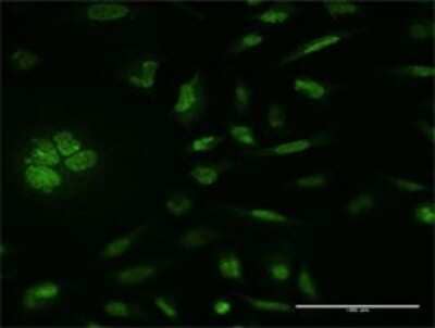 Immunocytochemistry/Immunofluorescence: MSK1/RPS6KA5 Antibody (1G7) [H00009252-M11] - Analysis of monoclonal antibody to RPS6KA5 on HeLa cell. Antibody concentration 10 ug/ml