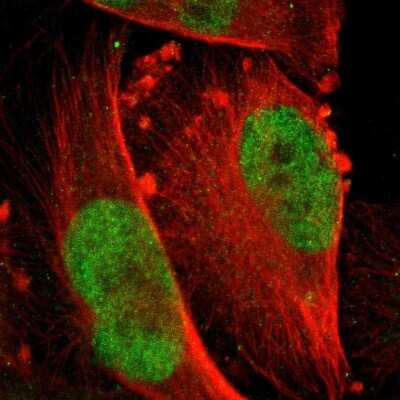 Immunocytochemistry/Immunofluorescence: MSK1/RPS6KA5 Antibody [NBP2-55624] - Staining of human cell line U-251 MG shows localization to nucleoplasm.