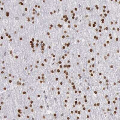 Immunohistochemistry-Paraffin: MSK1/RPS6KA5 Antibody [NBP1-82618] - Staining of human cerebral cortex shows strong nuclear positivity in neuronal cells and glial cells.