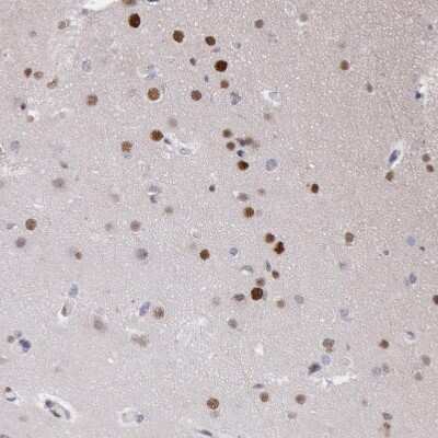 Immunohistochemistry-Paraffin: MSK1/RPS6KA5 Antibody [NBP1-82618] - Staining of human cerebral cortex shows moderate to strong nuclear positivity in neurons.