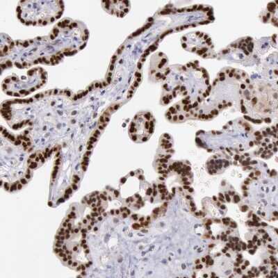 Immunohistochemistry-Paraffin: MSK1/RPS6KA5 Antibody [NBP1-82618] - Staining of human placenta shows strong nuclear positivity in trophoblastic cells.