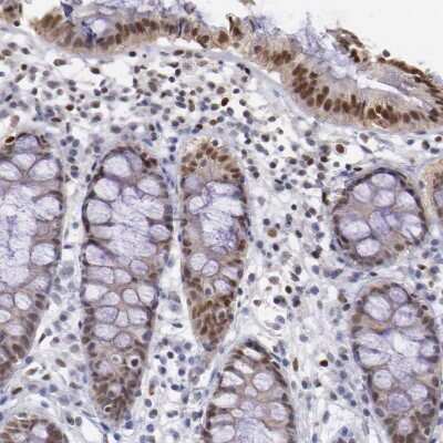 Immunohistochemistry-Paraffin: MSK1/RPS6KA5 Antibody [NBP1-82618] - Staining of human colon shows moderate to strong nuclear positivity in glandular cells.