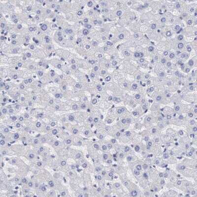 Immunohistochemistry-Paraffin: MSK1/RPS6KA5 Antibody [NBP1-82618] - Staining of human liver shows no positivity in hepatocytes as expected.