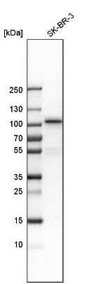 Western Blot: MSK1/RPS6KA5 Antibody [NBP1-82618] - Analysis in human cell line SK-BR-3.