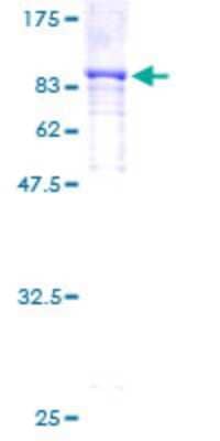 SDS-Page: MSK1/RPS6KA5 Recombinant Protein [H00009252-P01]