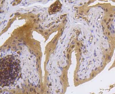 Immunohistochemistry-Paraffin: MSK1/RPS6KA5 [p Ser376] Antibody (SN63-05) [NBP2-67653] - Analysis of paraffin-embedded mouse bladder tissue using anti-MSK1(phospho S376) antibody. Counter stained with hematoxylin.