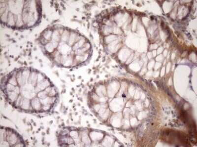 Immunohistochemistry: MSP/MST1 Antibody (OTI1A10) - Azide and BSA Free [NBP2-72792] - Analysis of Human colon tissue. (Heat-induced epitope retrieval by Tris-EDTA, pH8.0)