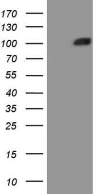 Western Blot: MSP/MST1 Antibody (OTI1A10) - Azide and BSA Free [NBP2-72792] - Analysis of HEK293T cells were transfected with the pCMV6-ENTRY control (Left lane) or pCMV6-ENTRY MST1.