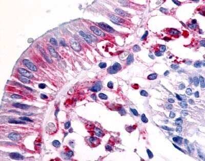 Immunohistochemistry-Paraffin: MSP R/Ron Antibody [NLS7186] - Analysis of anti-MST1R / RON antibody with small intestine, epithelium.