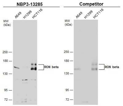 Western Blot: MSPR/Ron Beta Antibody [NBP3-13285] - Various whole cell extracts (30 ug) were separated by 5% SDS-PAGE, and the membranes were blotted with MSPR/Ron Beta antibody (NBP3-13285) diluted at 1:1000 and competitor's antibody diluted at 1:100. The HRP-conjugated anti-rabbit IgG antibody (NBP2-19301) was used to detect the primary antibody.