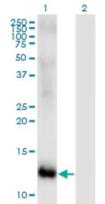 Western Blot: MSRB2 Antibody (2B7) [H00022921-M01] - Analysis of MSRB2 expression in transfected 293T cell line by MSRB2 monoclonal antibody (M01), clone 2B7.Lane 1: MSRB2 transfected lysate (Predicted MW: 11.11 KDa).Lane 2: Non-transfected lysate.