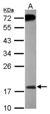 Western Blot: MSRB2 Antibody [NBP2-19420] - Sample (30 ug of whole cell lysate) A: MCF-7 12% SDS PAGE gel, diluted at 1:1000.