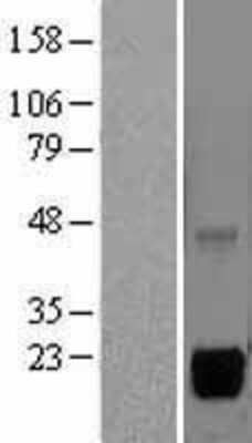 Western Blot: MSRB2 Overexpression Lysate (Adult Normal) [NBL1-13337] Left-Empty vector transfected control cell lysate (HEK293 cell lysate); Right -Over-expression Lysate for MSRB2.