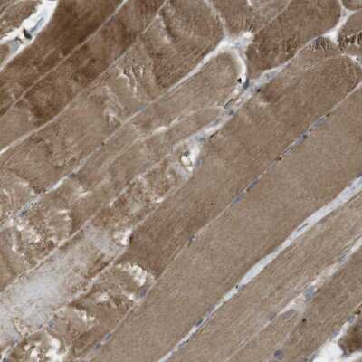 Immunohistochemistry-Paraffin: MSRB3 Antibody [NBP1-84259] - Staining of human skeletal muscle shows moderate cytoplasmic positivity in myocytes.