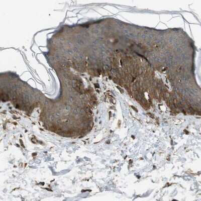 Immunohistochemistry-Paraffin: MSRB3 Antibody [NBP1-84259] - Staining of human skin shows moderate cytoplasmic positivity in squamous epithelial cells.