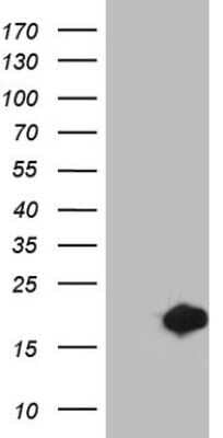 Western Blot: MSRB3 Antibody (OTI2A2) - Azide and BSA Free [NBP2-72793] - Analysis of HEK293T cells were transfected with the pCMV6-ENTRY control (Left lane) or pCMV6-ENTRY MSRB3 .