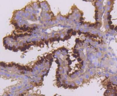Immunohistochemistry-Paraffin: MST1/2 Antibody (SC05-83) [NBP2-67624] - Analysis of paraffin-embedded mouse placenta tissue using anti-Mst2 antibody. Counter stained with hematoxylin.