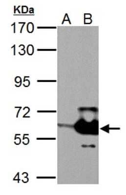 Western Blot: MST2 Antibody [NBP2-19421] - Sample (30 ug of whole cell lysate) A: Non-transfected 293T lysates B: STK3 transfected 293T lysates 7. 5% SDS PAGE gel, diluted at 1:5000.