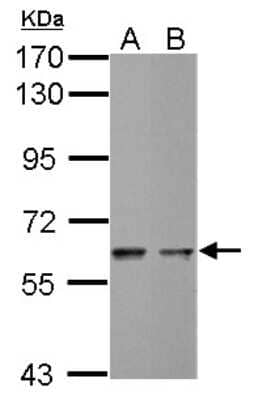 Western Blot: MST2 Antibody [NBP2-19421] - Sample (30 ug of whole cell lysate) A: THP-1 B: NCI-H929 7. 5% SDS PAGE gel, diluted at 1:1000.