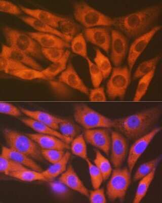 Immunocytochemistry/Immunofluorescence: MST2/STK3 Antibody (5J1I4) [NBP3-16737] - Immunofluorescence analysis of NIH-3T3 cells using MST2/STK3 Rabbit mAb (NBP3-16737) at dilution of 1:100 (40x lens). Blue: DAPI for nuclear staining.