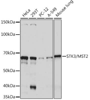 Western Blot: MST2/STK3 Antibody (5J1I4) [NBP3-16737] - Western blot analysis of extracts of various cell lines, using MST2/STK3 Rabbit mAb (NBP3-16737) at 1:1000 dilution. Secondary antibody: HRP Goat Anti-Rabbit IgG (H+L) at 1:10000 dilution. Lysates/proteins: 25ug per lane. Blocking buffer: 3% nonfat dry milk in TBST. Detection: ECL Basic Kit. Exposure time: 1s.