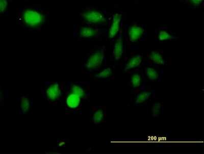 Immunocytochemistry/Immunofluorescence: MST2/STK3 Antibody [H00006788-B01P] - Analysis of purified antibody to STK3 on HeLa cell. (antibody concentration 10 ug/ml)